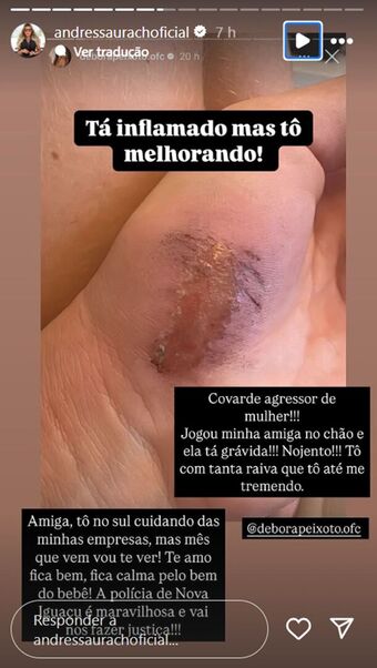 Tretas Nude Leaks OnlyFans Photo 47